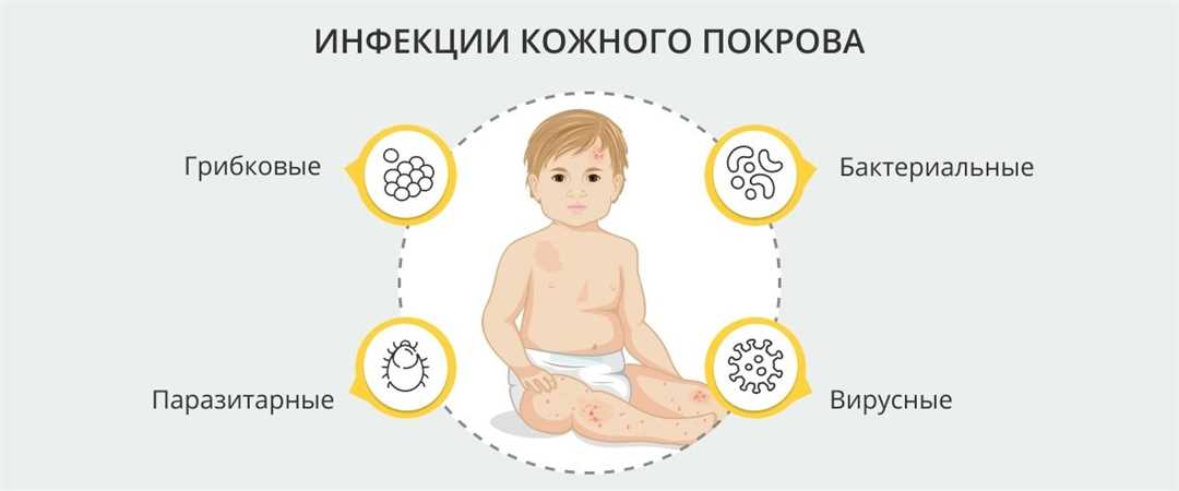 Бактериальные инфекции у новорожденных детей: симптомы, диагностика и лечение