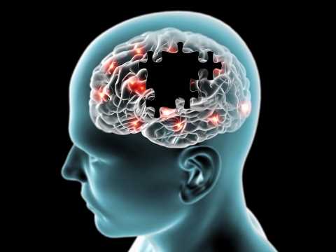 Основные преимущества МРТ в диагностике нейродегенеративных заболеваний: