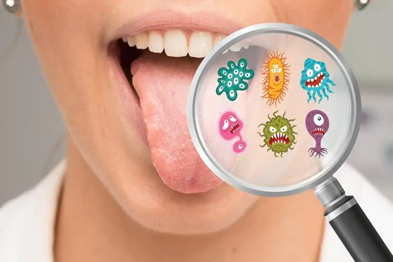 Эффективные методы лечения бактериальной инфекции в полости рта