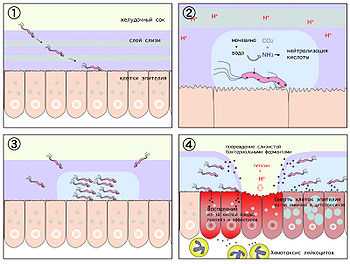 Иммунный ответ на Helicobacter pylori: механизмы и роль в патогенезе