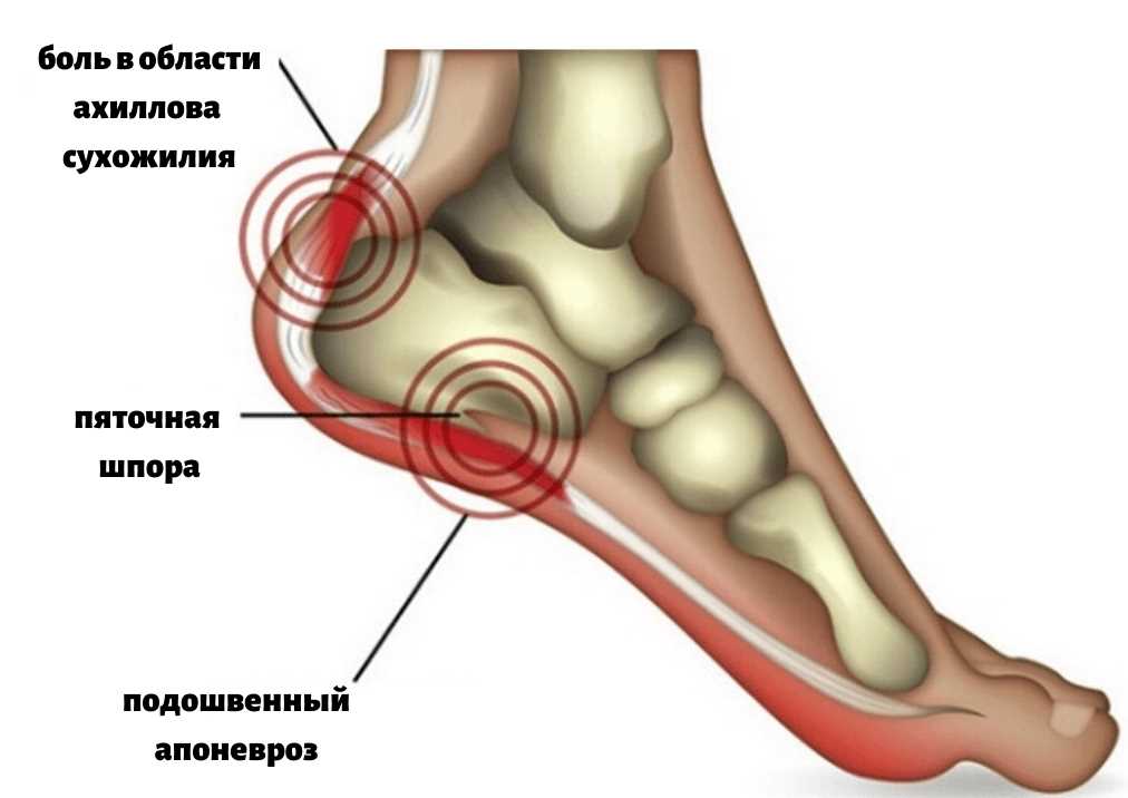 Лечение воспаления мягких тканей ноги: препараты