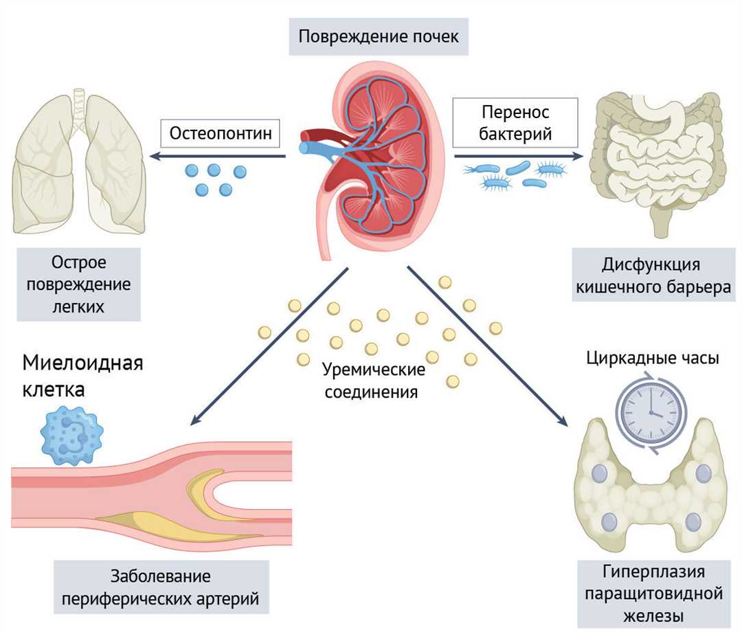 Фундаментальная роль липоидоза в механизмах атеросклероза