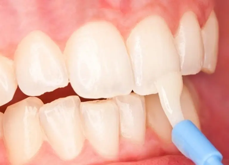 Профилактика патологических гетерогенных процессов на поверхности зубной эмали