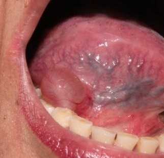 Системные заболевания и их влияние на полость рта