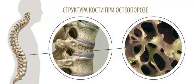 Повреждение плечевого сустава, запястья и стопы: травмы кистей и стоп