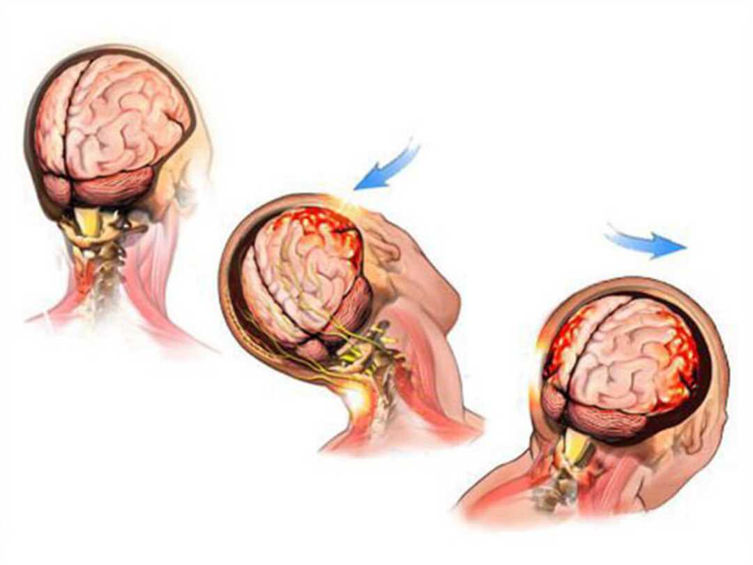 Диагностика повреждения мягких тканей головы