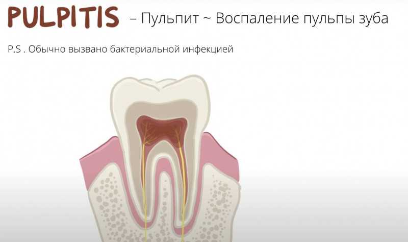 Повреждение мягких тканей при удалении зуба: причины, симптомы, лечение