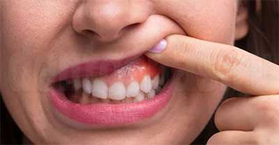 Симптомы травм мягких тканей зуба