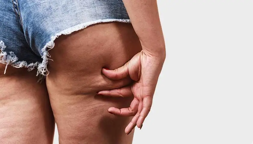 Повреждение жировой ткани: причины, последствия, и как с ним бороться