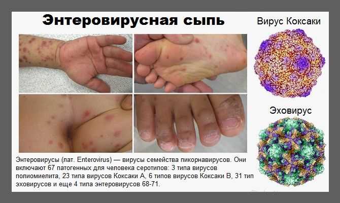 Диагностика бактериальной инфекции кожи у детей
