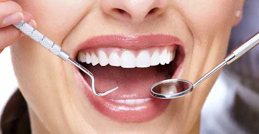 Связь зубного камня и воспаления тканей пародонта: причины и способы профилактики