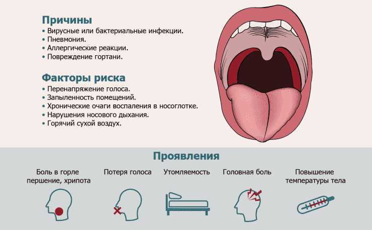 Различия между бактериальными и вирусными инфекциями горла