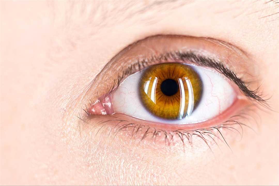 Основные методы лечения воспаления мягких тканей глаза