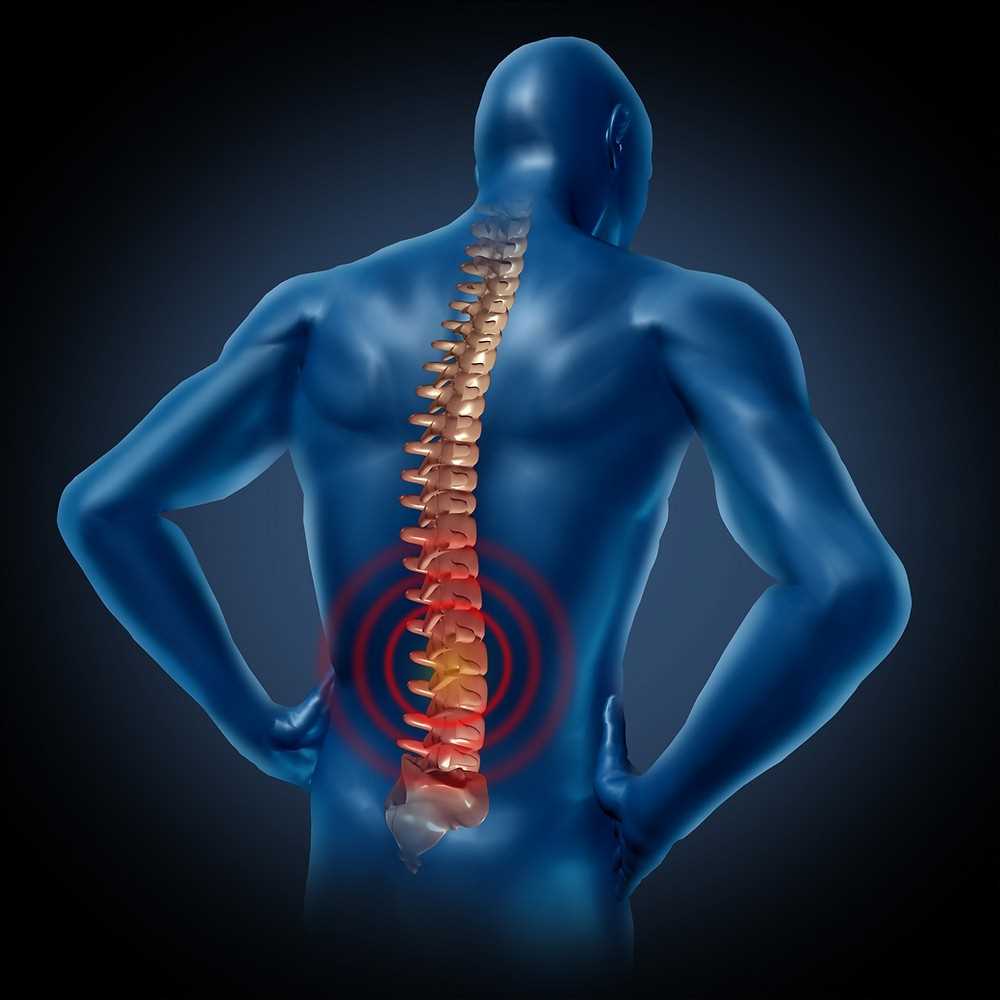 Воспаление мягких тканей спины: симптомы и эффективное лечение