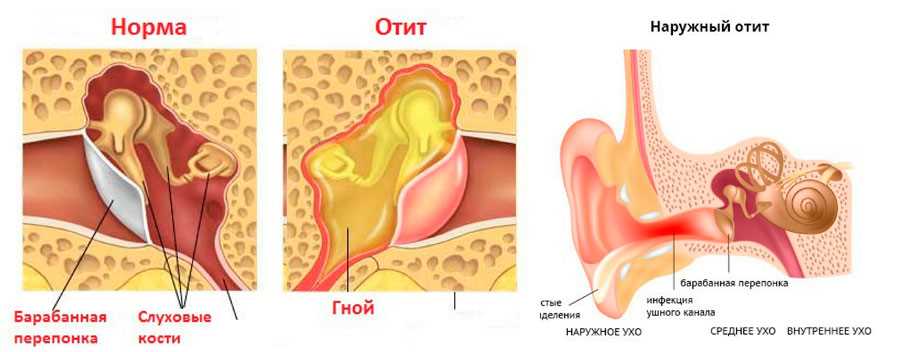 Диагностика воспаления хрящевой ткани уха