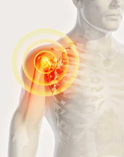 Лечение и профилактика травм и повреждений плечевого сустава