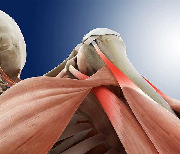 Воспаление мышечной ткани плечевого сустава — причины, симптомы и методы лечения, которые помогут вернуть здоровье и мобильность руки!